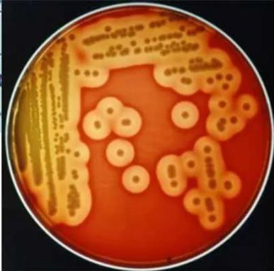 蠟樣芽孢桿菌的生長環境、形態特征、培養特性、實驗室診斷等知識匯總